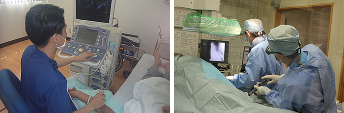 PTA(経皮的血管形成術)