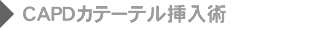 CAPDカテーテル挿入術